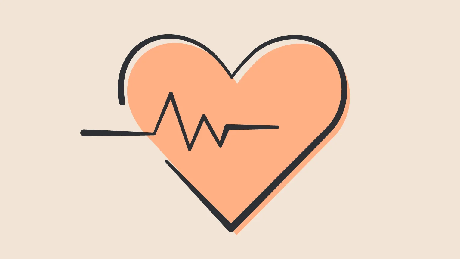 Mehr zum Thema Paare sollen sich gegenseitig Nieren spenden dürfen