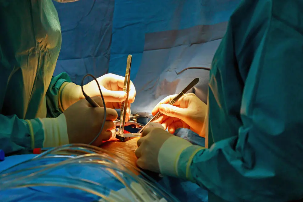Debatte über Krankenhausreform Eine Operation im Krankenhaus.