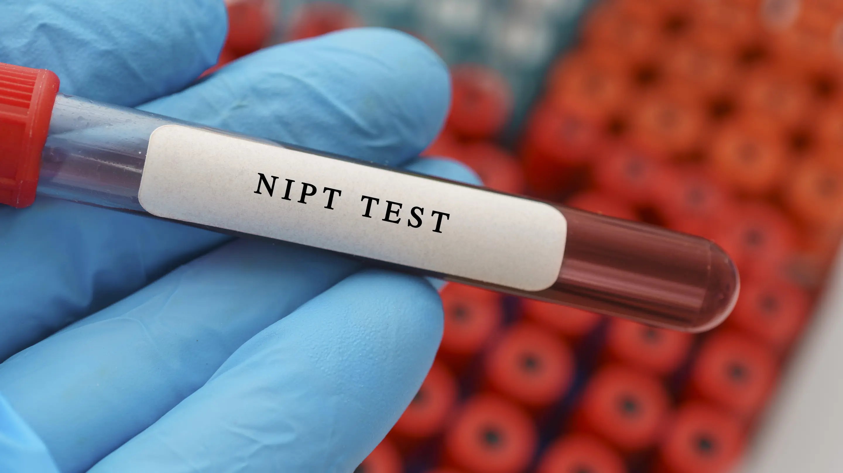 Nicht-invasiver Pränataltest Nicht-invasiver Pränataltest
