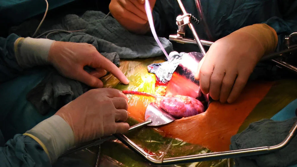 Überkreuzspende soll Leben retten